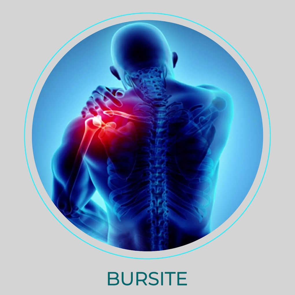 bursite-doctor-clinica-da-dor-campo-grande-ms