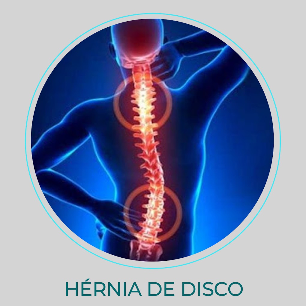 hernia-de-disco-doctor-clinica-da-dor-campo-grande-ms