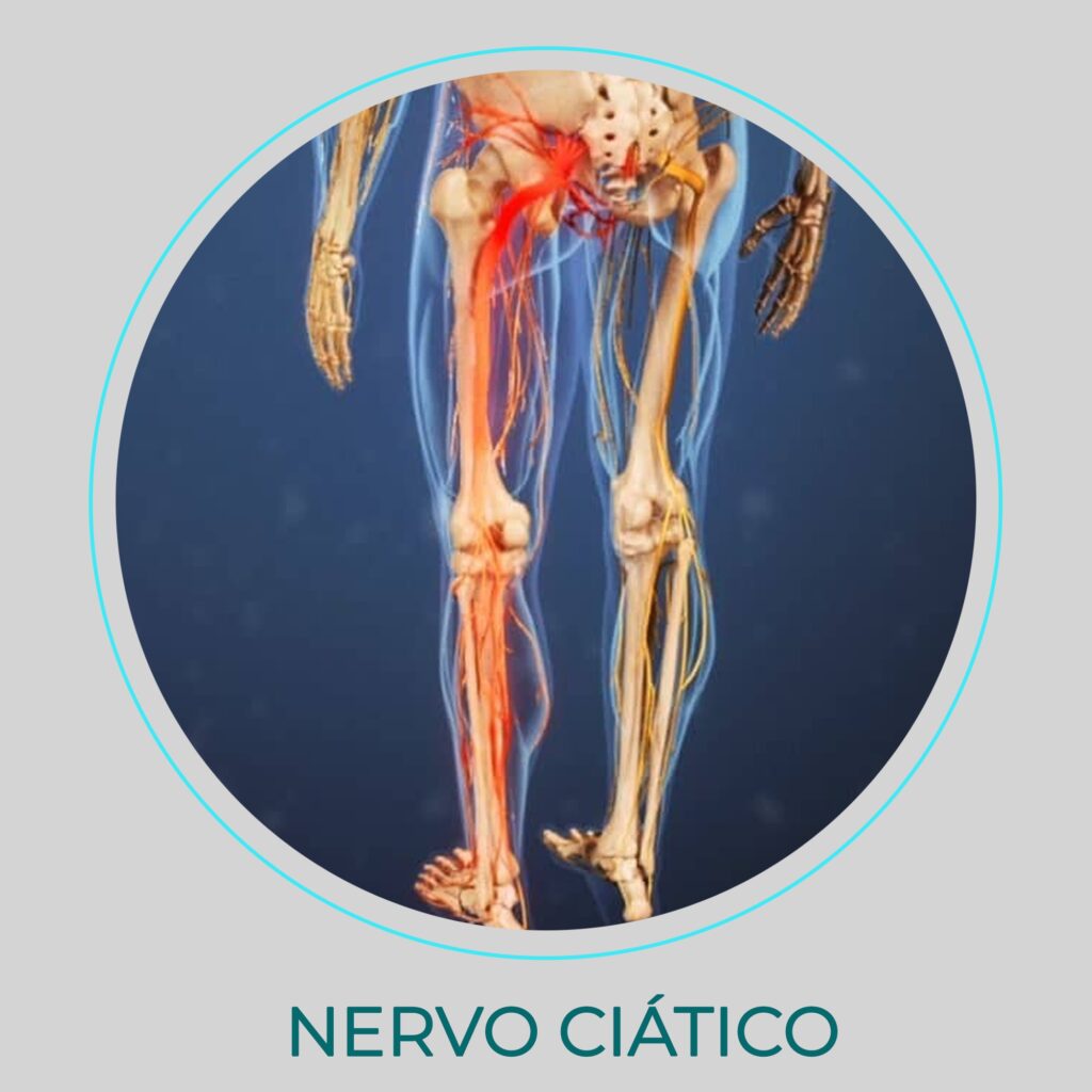 nervo-ciatico-clinica-da-dor-campo-grande-ms